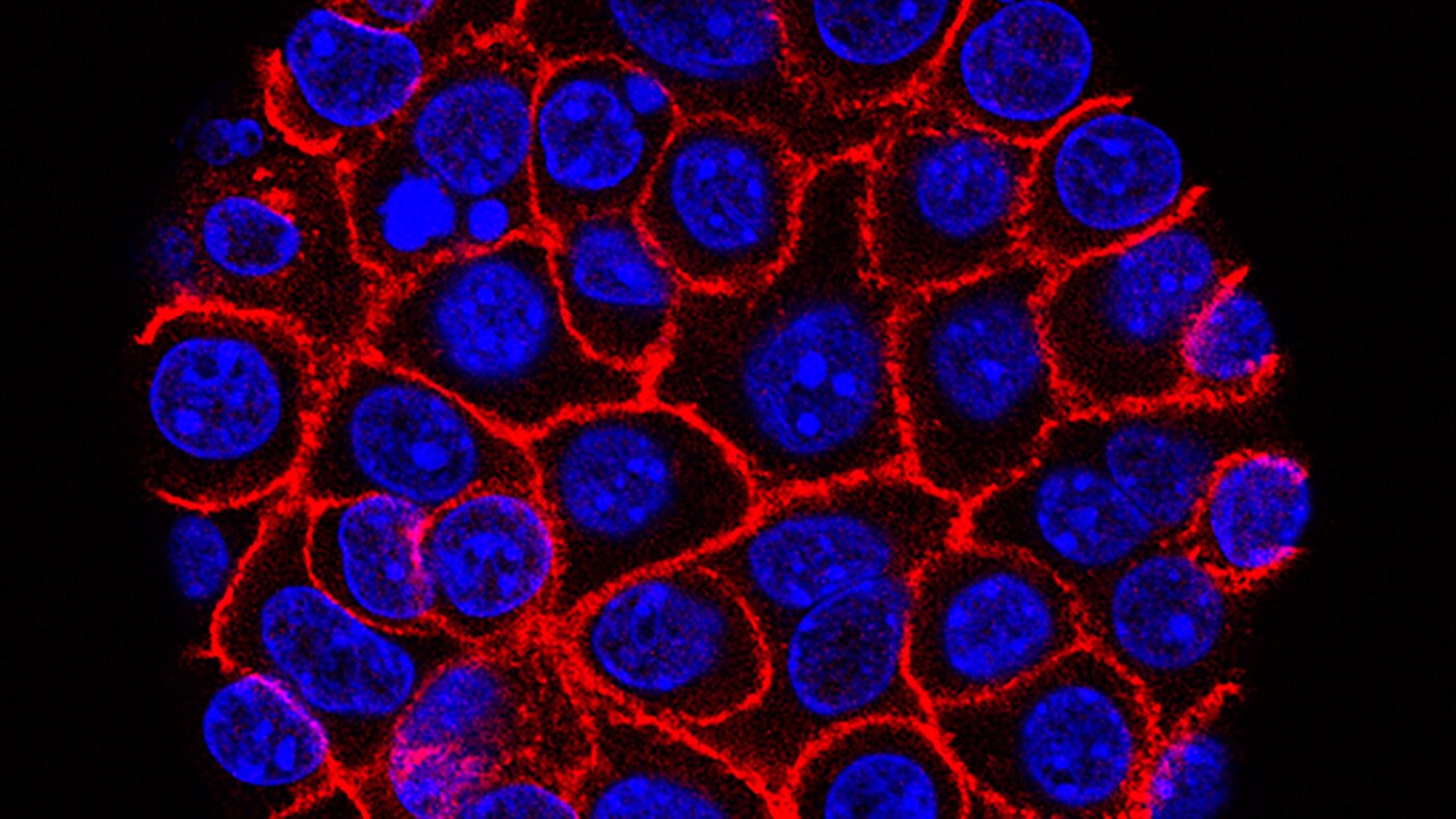 膵臓がん新薬が治験で生存期間を約2倍に。「創薬不能」とされたKRAS変異を初めて攻略