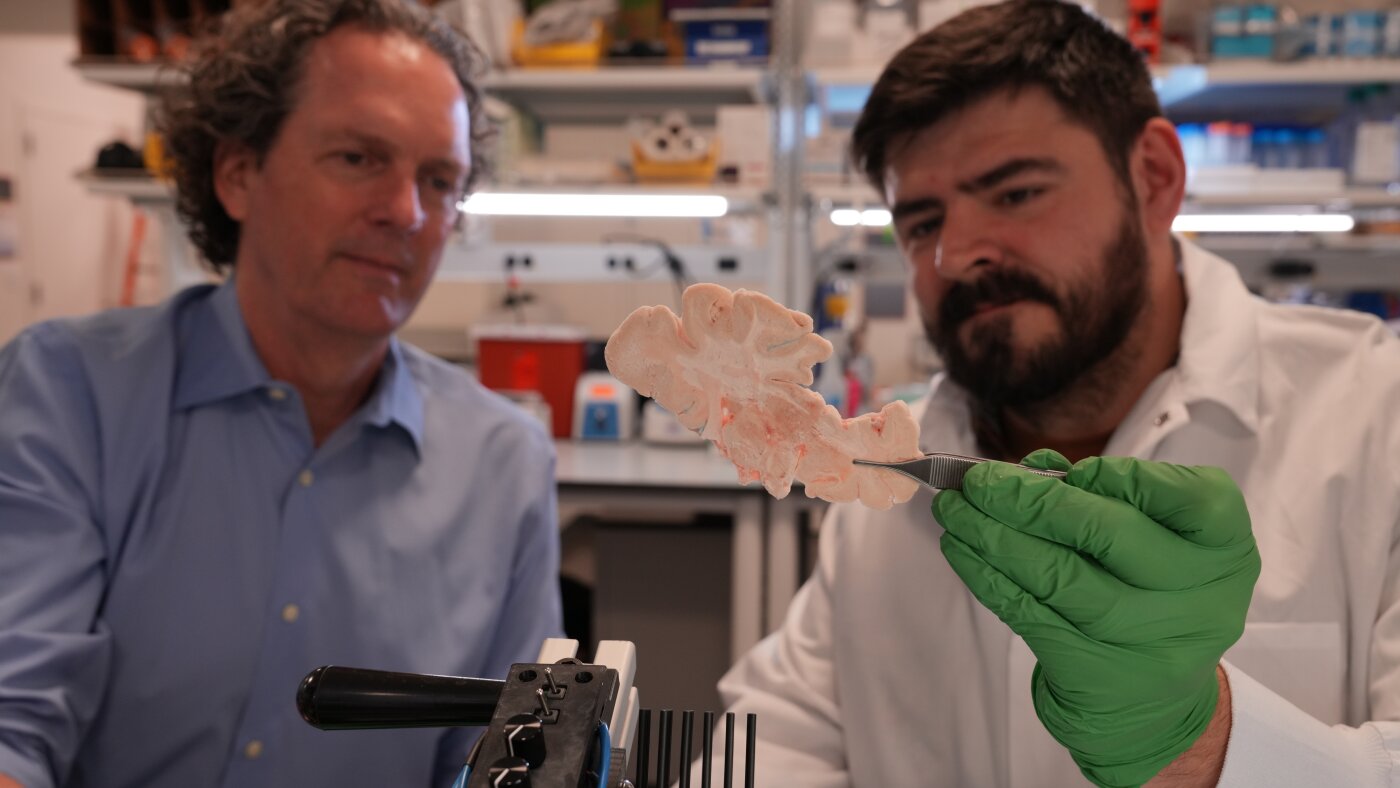 アレン研究所が4億ドルの脳科学計画を始動。遺伝子治療でアルツハイマーに挑む