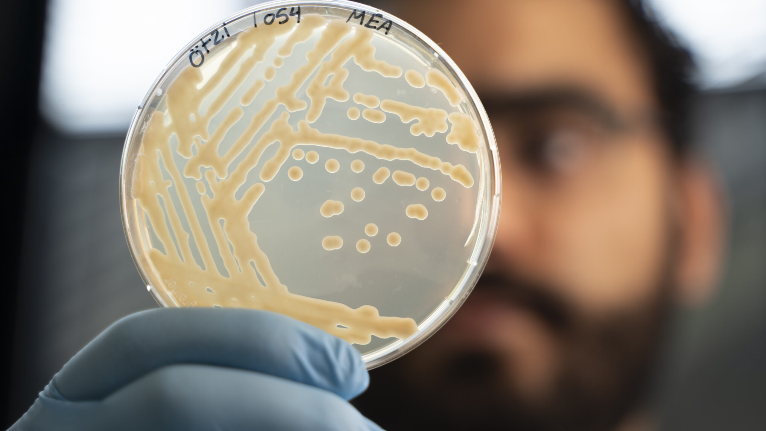 エッツィの体で微生物4種が5,300年を生き延びた。氷漬けミイラの中で今も増殖を続ける